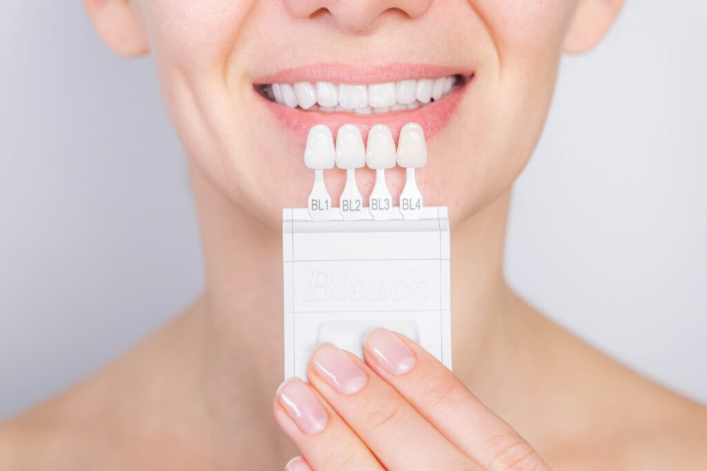 What Are Porcelain Veneers? Everything Philadelphia Patients Should Know